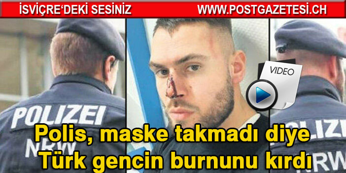 Almanya'da polis maske takmadı diye Türk gencin burnunu kırdı