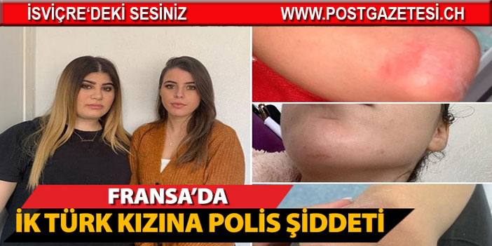 Fransa’da iki Türk genç kıza polis şiddeti