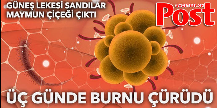 Güneş lekesi sandılar, maymun çiçeği çıktı: Üç günde burnu çürüdü!