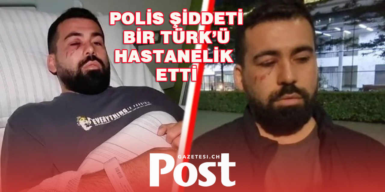 Almanya’da yanlış eve baskın yapan polis Türk gencini hastanelik etti