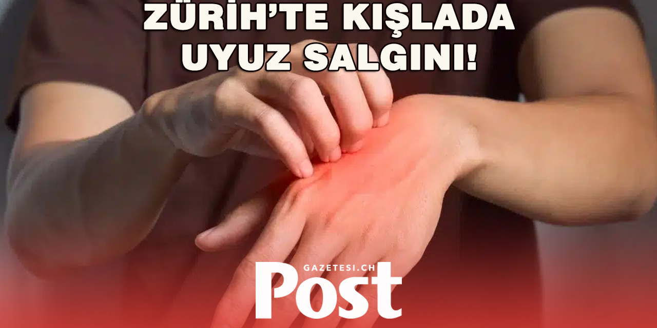 Kloten’de Askeri Kışlada Uyuz Vakaları!