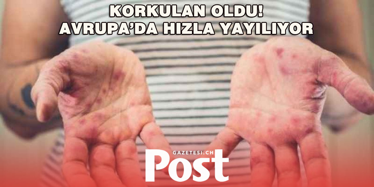 Şap hastalığı Avrupa’da yayılmaya başladı