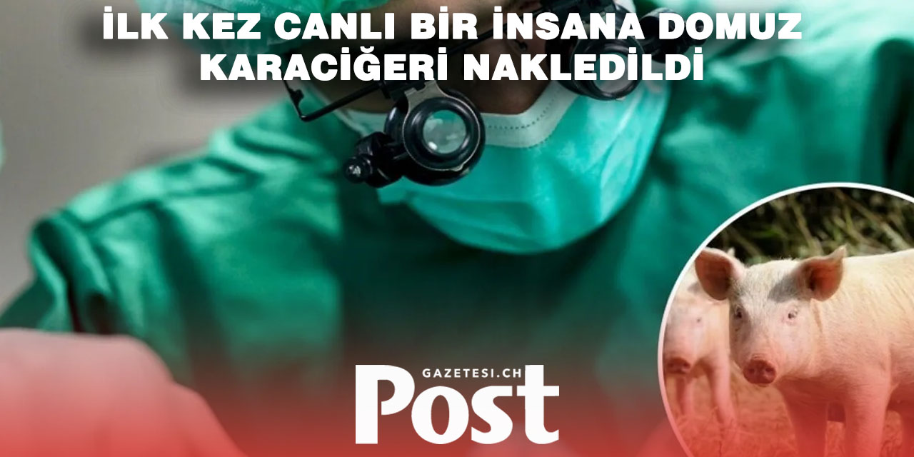 Tarihte ilk kez bir insana domuz karaciğeri nakledildi