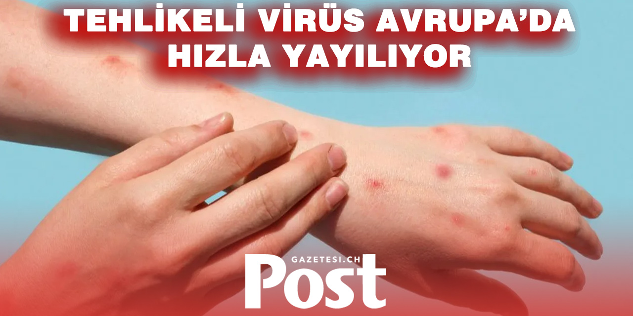 Avrupa’da tehlike büyüyor! Dayanılmaz ağrılı virüs yayılıyor