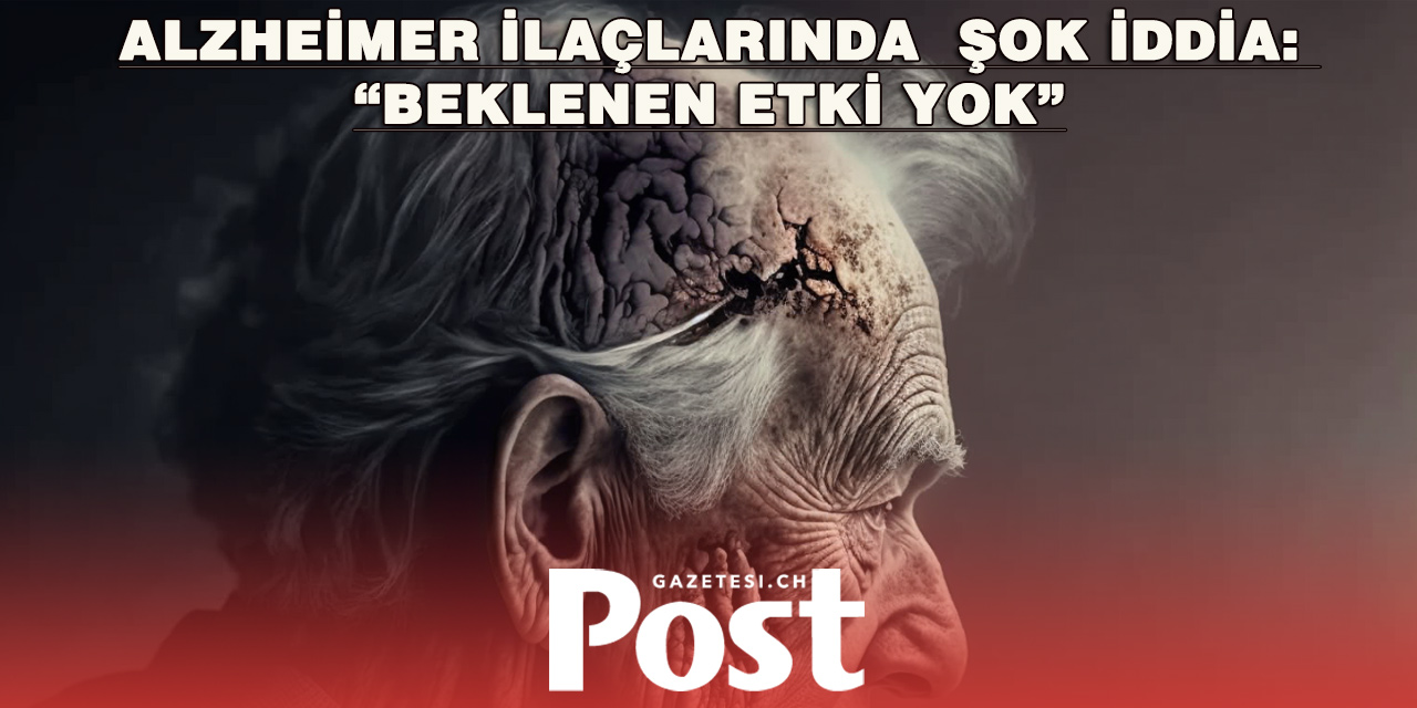 Alzheimer tedavisinde umutlar sorgulanıyor: Yeni ilaçlara eleştiri