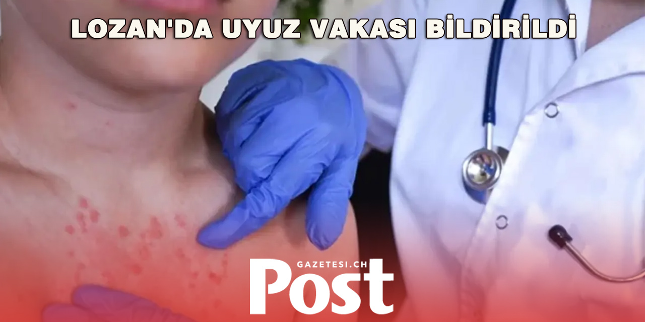 Lozan’da okulda uyuz alarmı! Velilere uyarı mektubu gönderildi