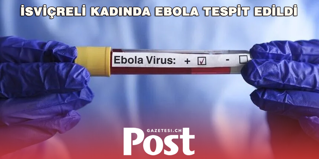 Nijerya’da İsviçreli Kadına Ebola Teşhisi Konuldu